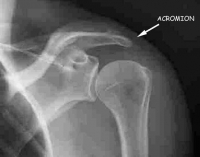 Profilbilde for Acromion